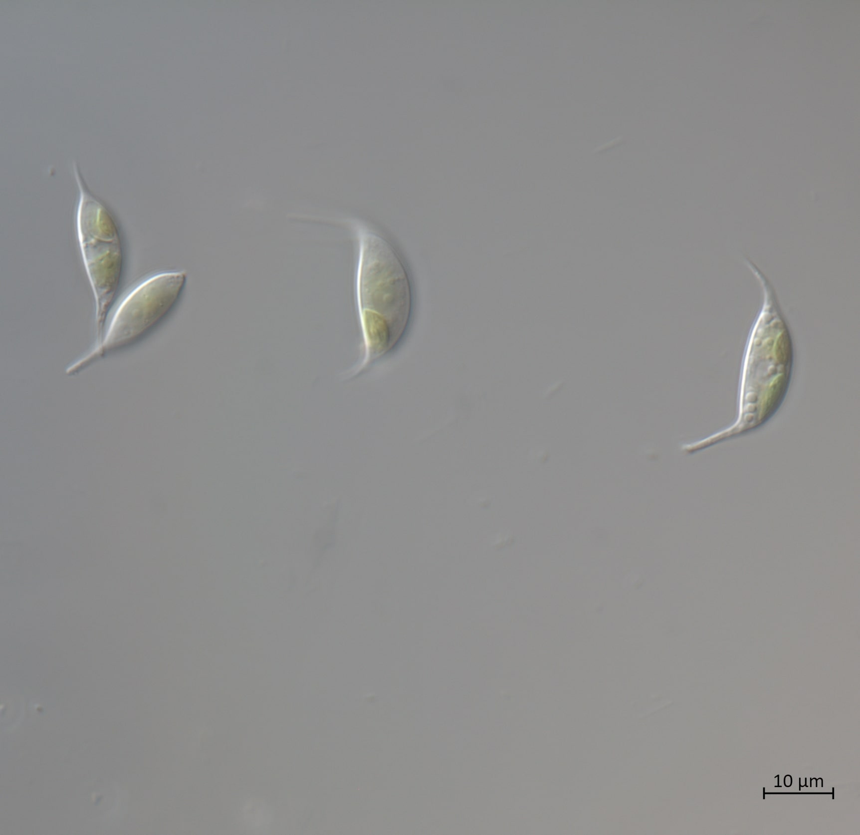 A1_1_Keratococcus-x63-G-min