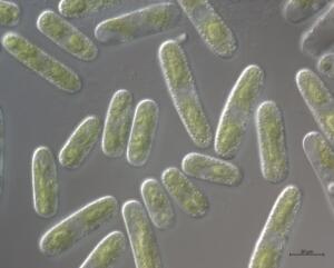 A2_2-Cylindrocystis-x63-C-min