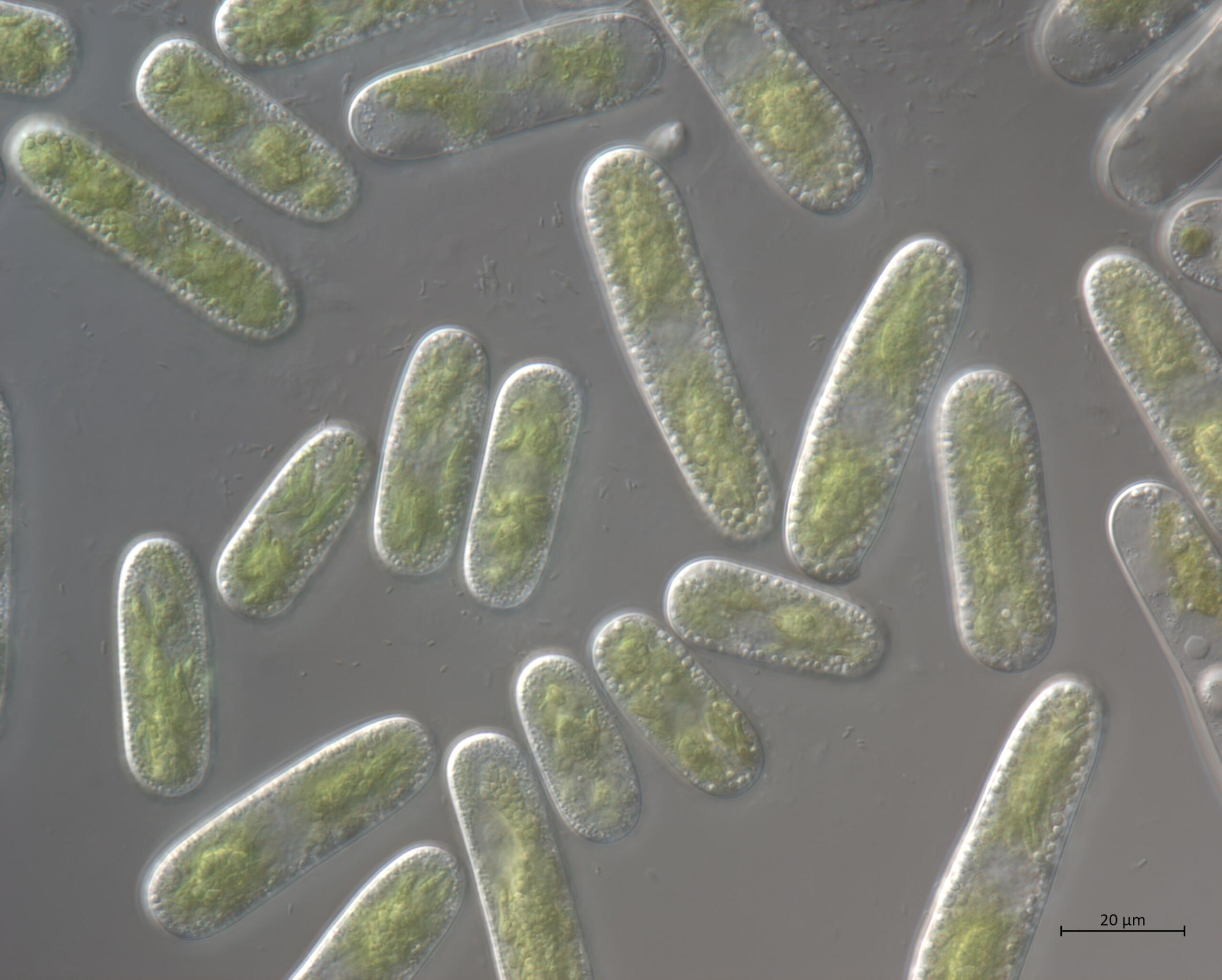 A2_2-Cylindrocystis-x63-C-min